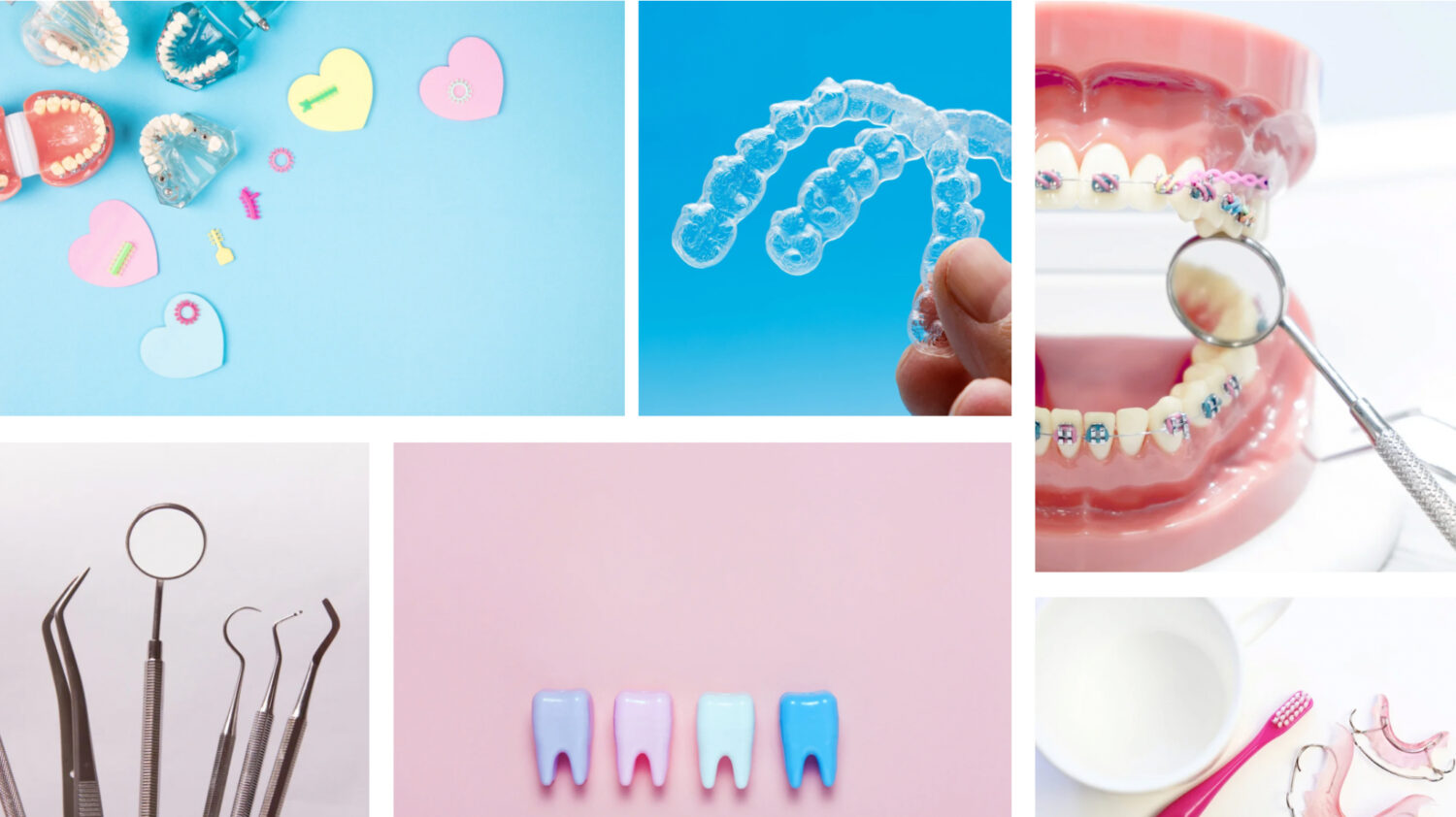 矯正治療に関する様々なイラスト